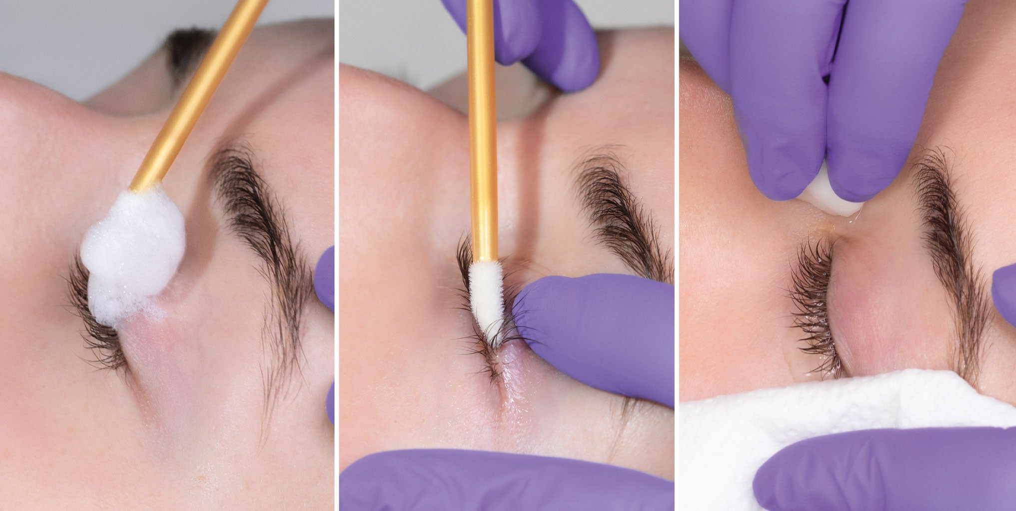 Consultation and Prep